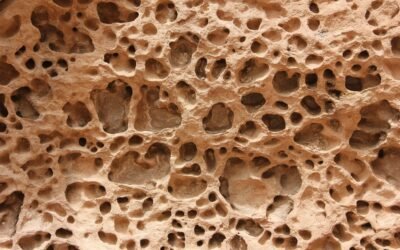 Osteoporosis: When Bones Break Easily